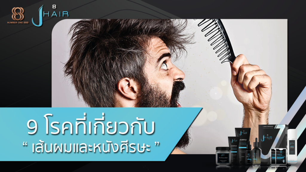 9โรคเกี่ยวกับ เส้นผม หนังศีรษะ J Hair - สาระน่ารู้จาก Jhair