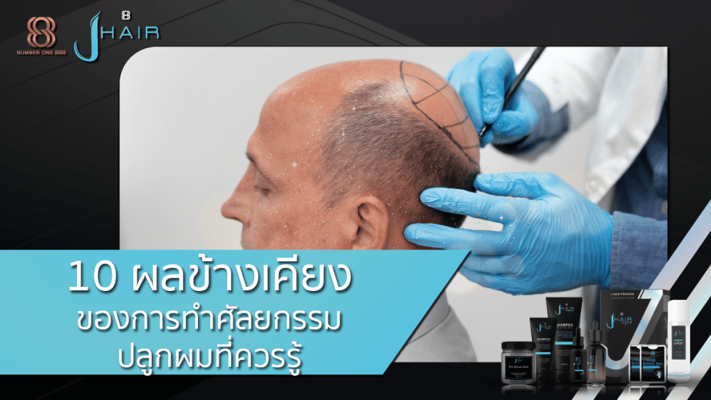 10 ผลข้างเคียงของการทำศัลยกรรมปลูกผมที่คุณควรรู้ - สาระน่ารู้จาก Jhair