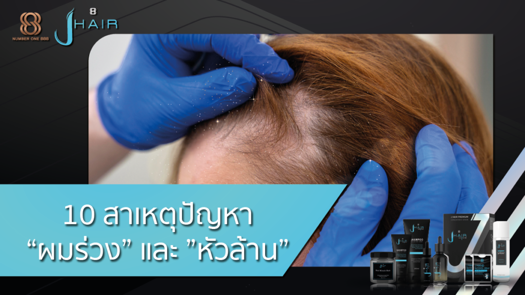 ผมร่วง-หัวล้าน-แก้ปัญหาผมร่วง-Jhair serum