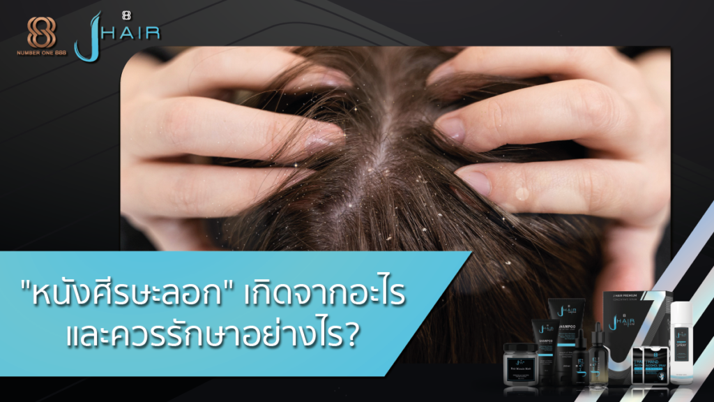 หนังศีรษะลอก-รักษาหนังศีรษะลอก-J hair serum
