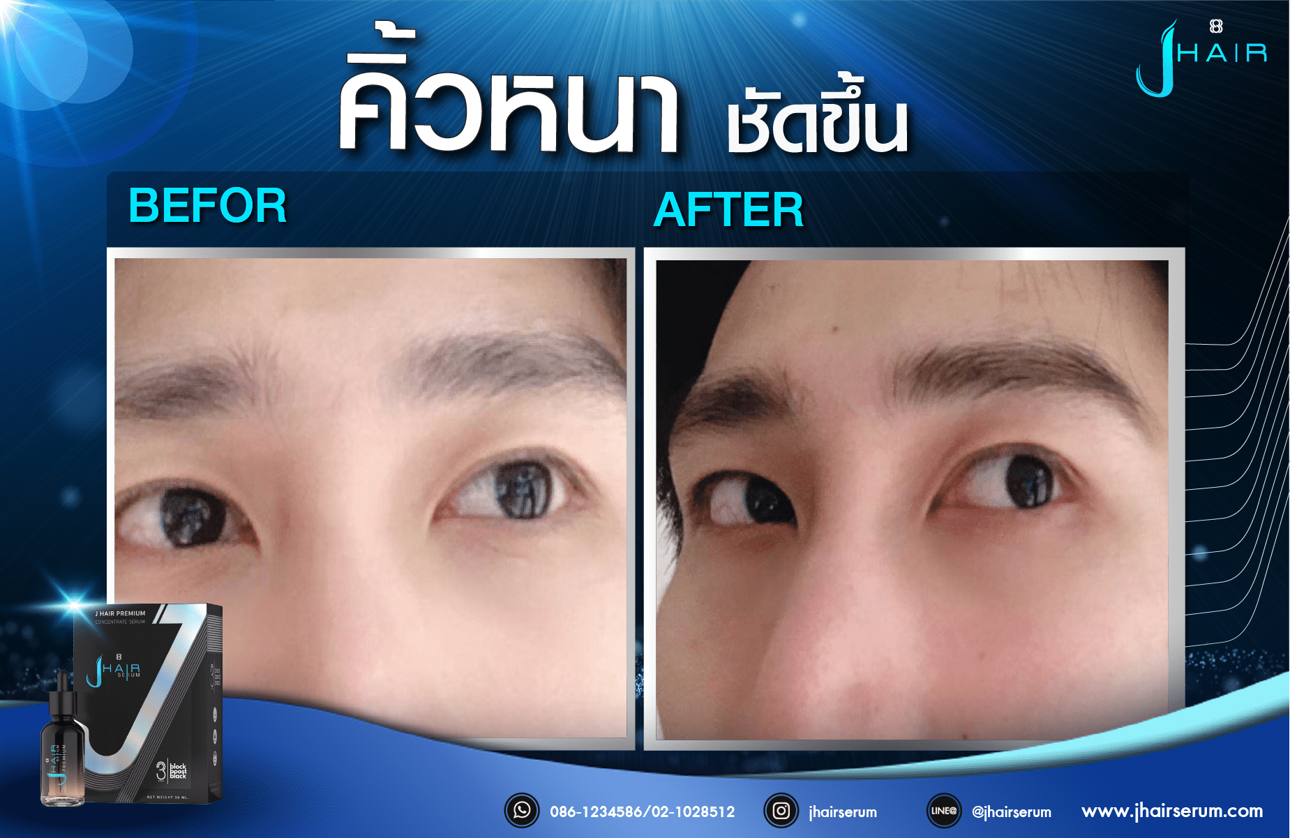 รีวิวจากผู้ใช้จริง J HAIR SERUM เซรั่มปลูกผม