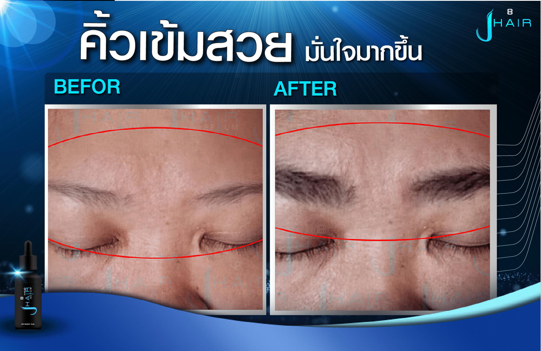 รีวิวจากผู้ใช้จริง J HAIR SERUM เซรั่มปลูกผม