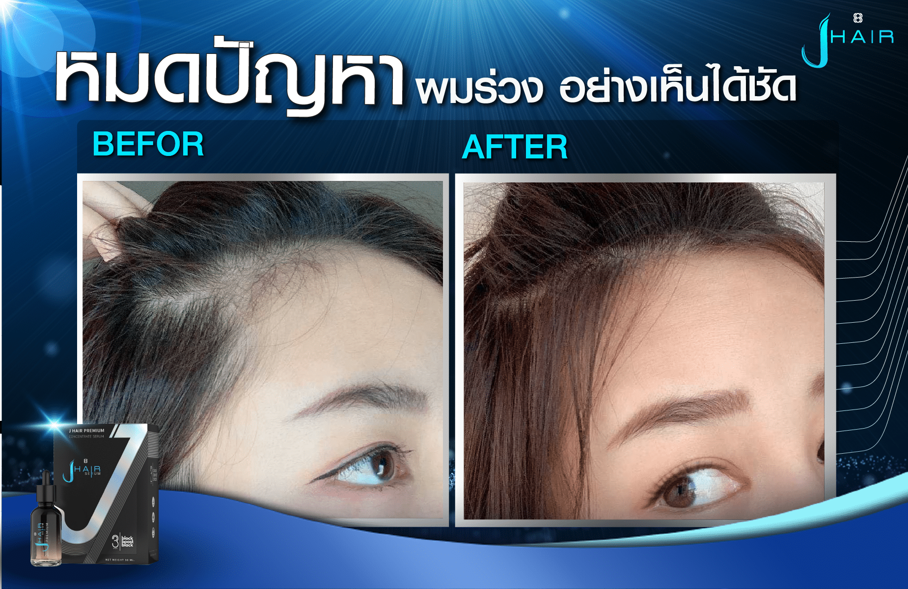 รีวิวจากผู้ใช้จริง J HAIR SERUM เซรั่มปลูกผม