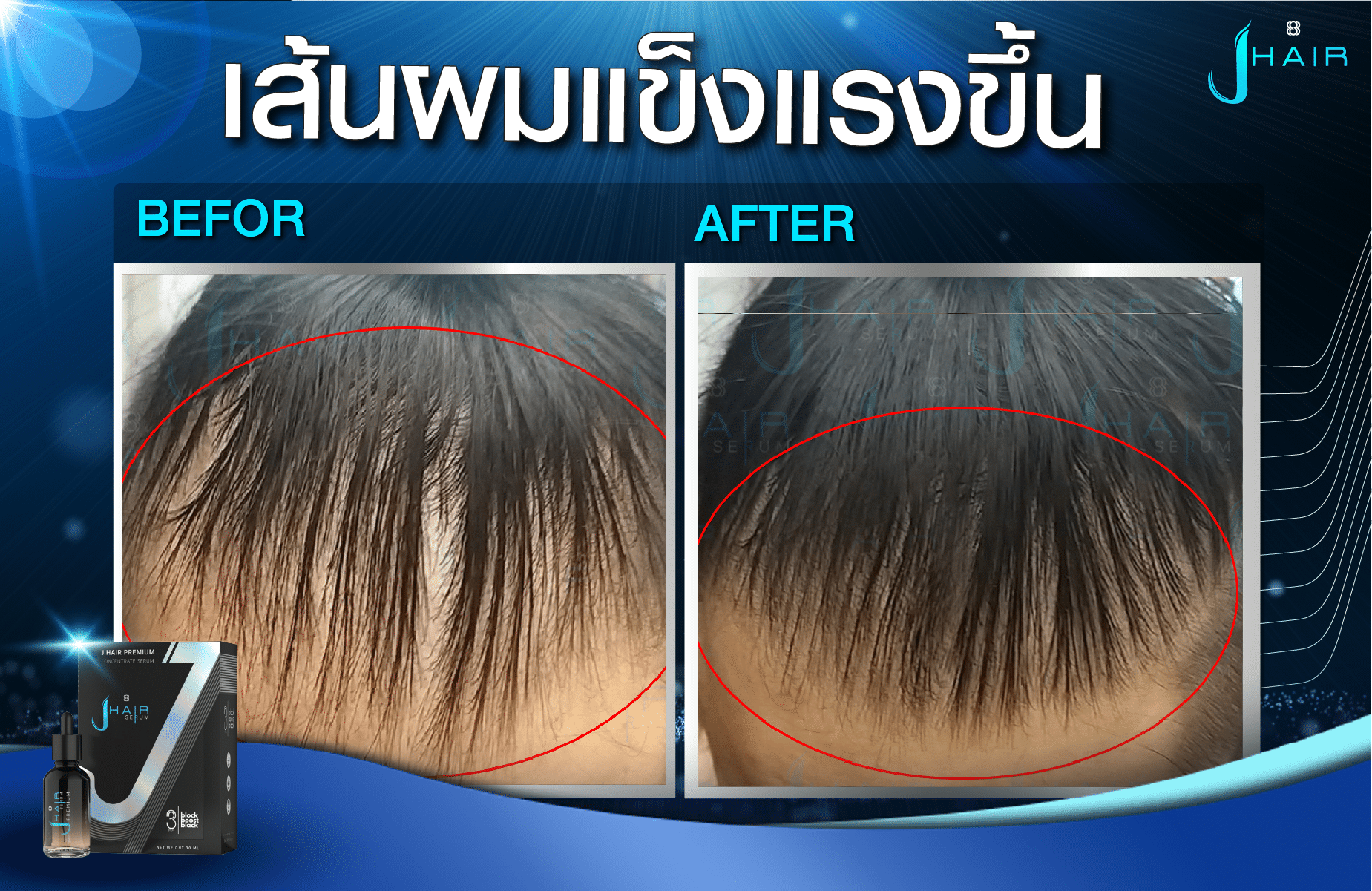 รีวิวจากผู้ใช้จริง J HAIR SERUM เซรั่มปลูกผม