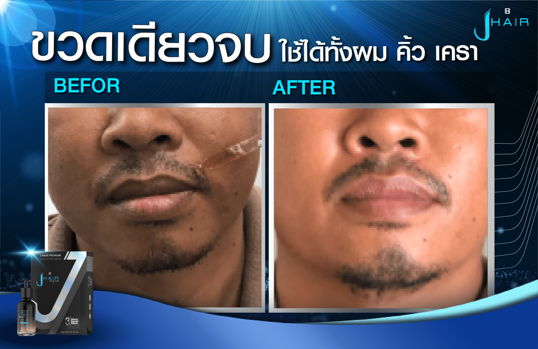 รีวิวจากผู้ใช้จริง J HAIR SERUM เซรั่มปลูกผม
