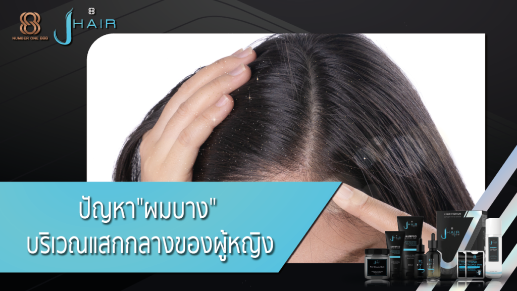 ผมบาง-ผมบางผู้หญิงวิธีแก้ผมบาง-jhair serum