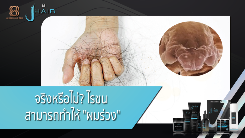 รักษาผมร่วง-ผมร่วง-Jhair serum