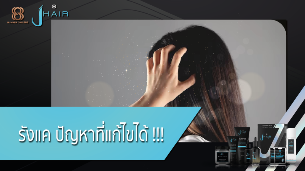 รังแค-ปัญหารังแค-Jhair serum