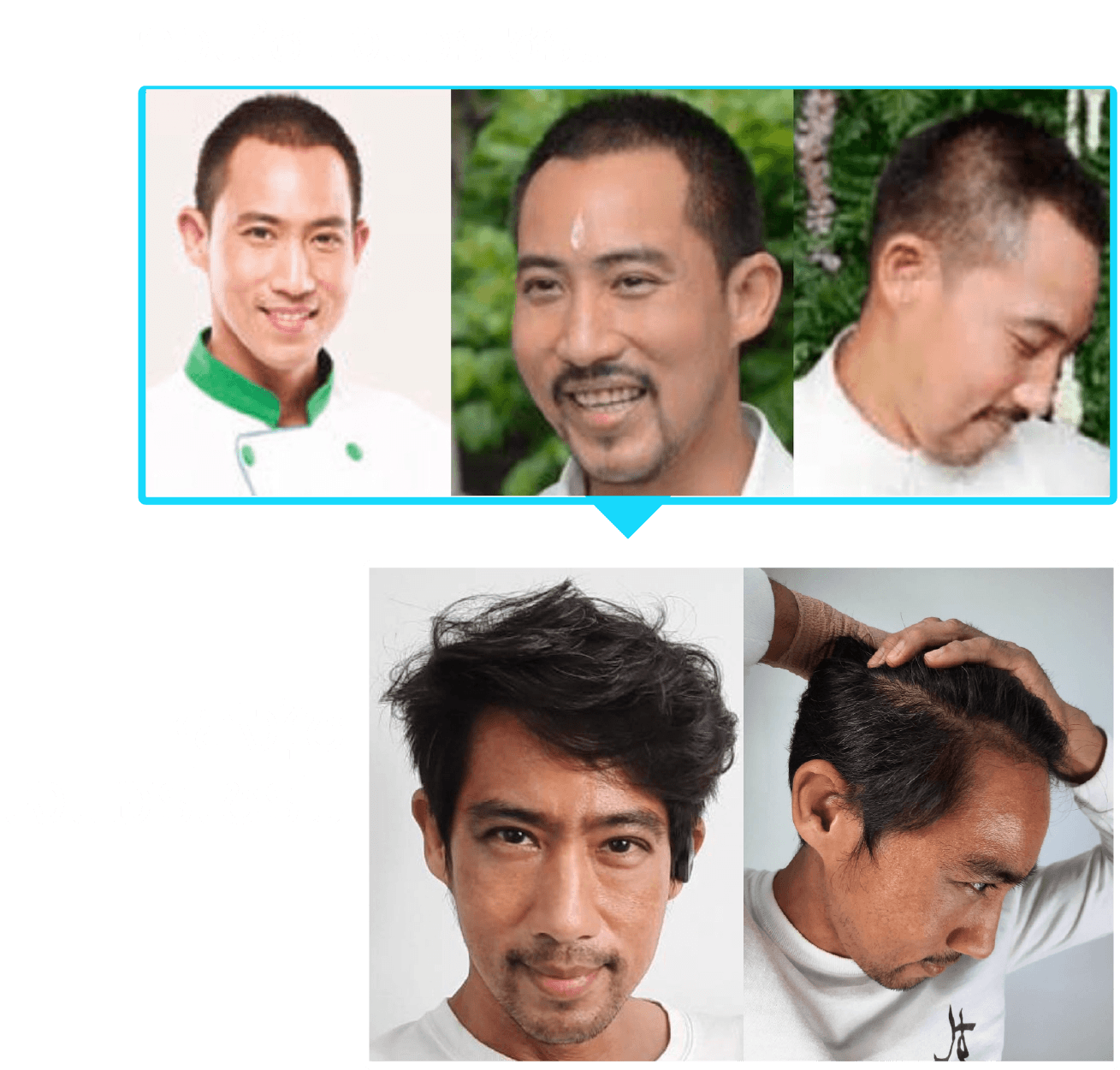 J HAIR Serum รีวิว จากคุณตั๊ก นภัสรัญชน์ มิตรธีรโรจน์