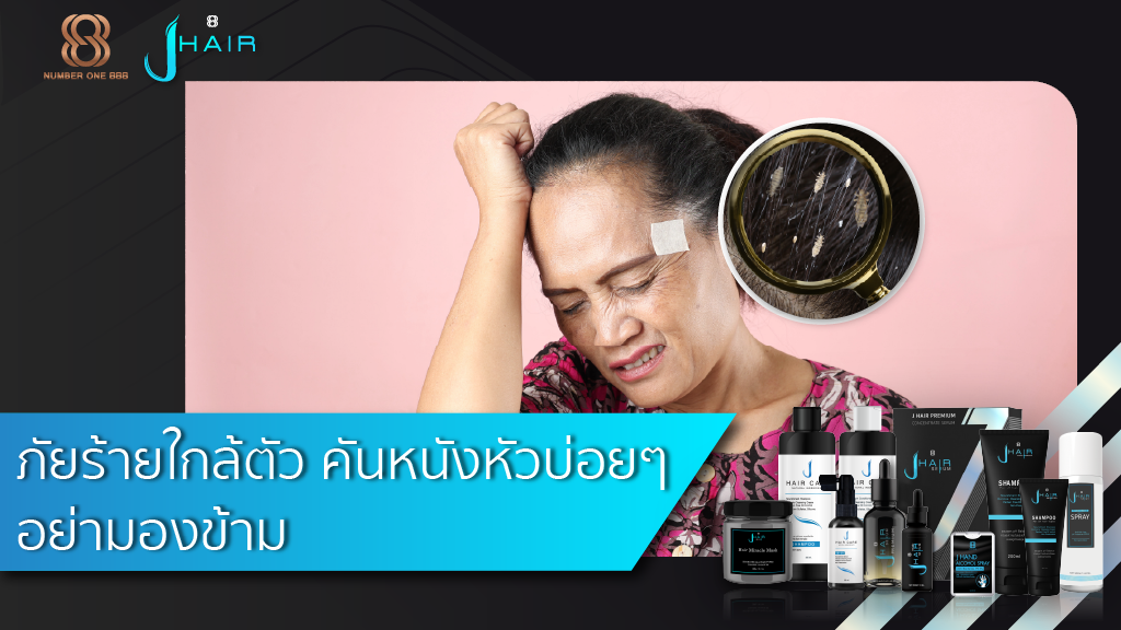 ภัยร้ายใกล้ตัว คันหนังหัวบ่อยๆ อย่ามองข้าม