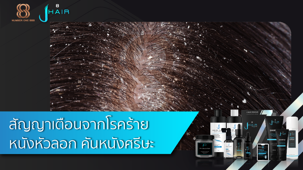 สัญญาเตือนจากโรคร้าย หนังหัวลอก คันหนังศรีษะ