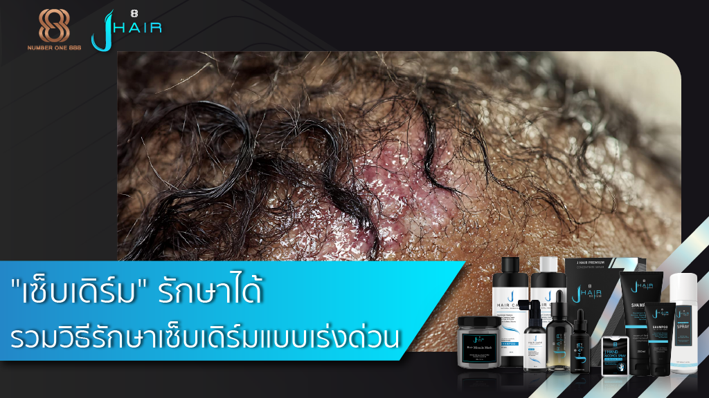 "เซ็บเดิร์ม" รักษาได้ รวมวิธีรักษาเซ็บเดิร์มแบบเร่งด่วน