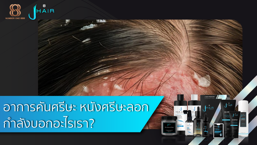 อาการคันศรีษะ หนังศรีษะลอก กำลังบอกอะไรเรา